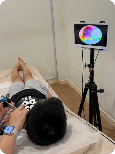 endoscope ear cleaning image (3)